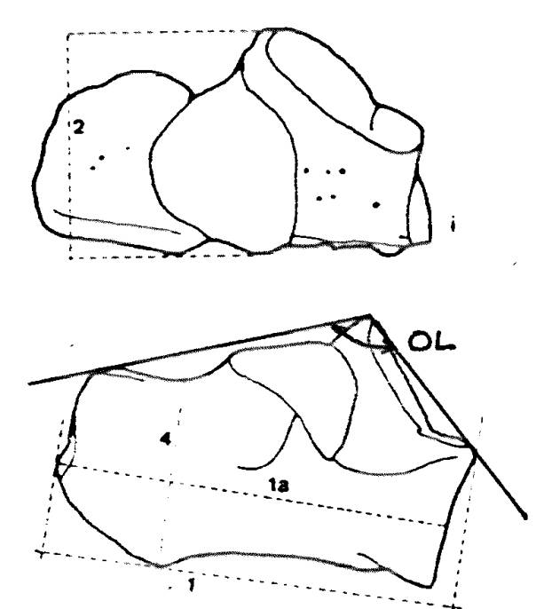 image011 calcaneum 2.jpg